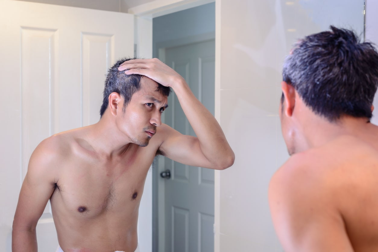 Penyebab Rambut Beruban Di Usia Muda Dan Cara Mencegahnya Honestdocs