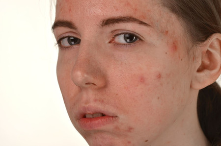 What Are The Dangers Of Using Too Much Skincare On Facial Skin?