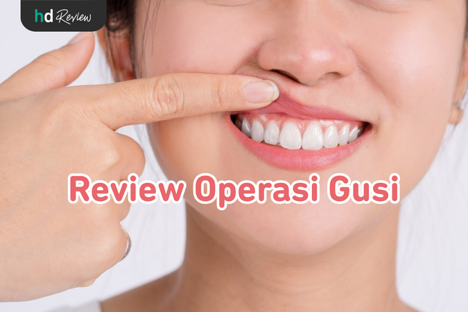 Operasi Gusi reviews