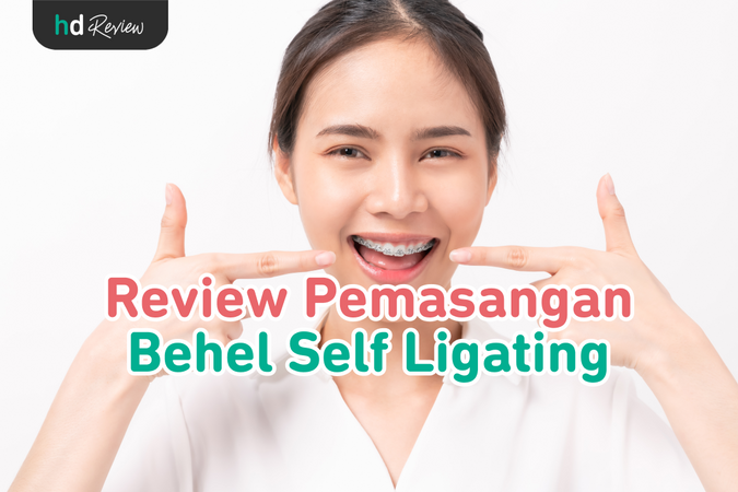 Pemasangan Behel Self Ligating reviews
