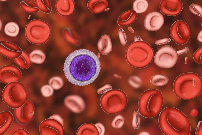 Thalasemia (Thalassemia)