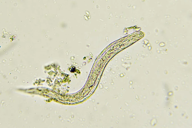 Strongyloidiasis (Strongiloidiasis)