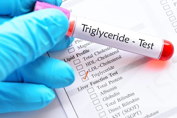 Trigliserida (Triglycerides)