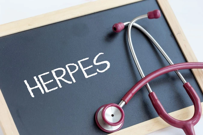 Herpes