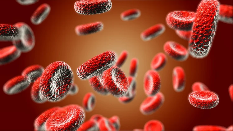 Anemia