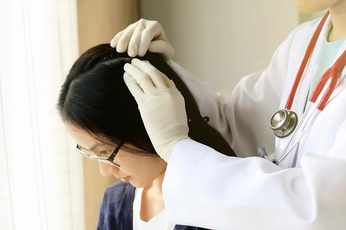 Dermatitis Seboroik (Seborrheic Dermatitis)