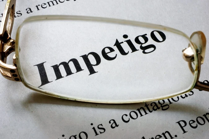 Impetigo