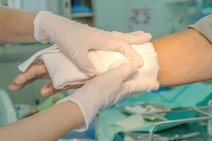 Rheumatoid Arthritis