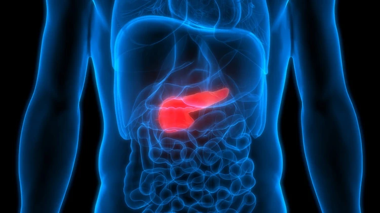 Pankreatitis Akut (Acute Pancreatitis)