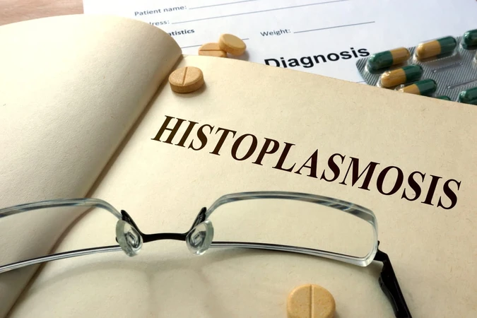 Histoplasmosis
