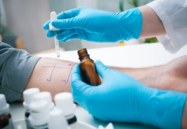 Alergi Obat