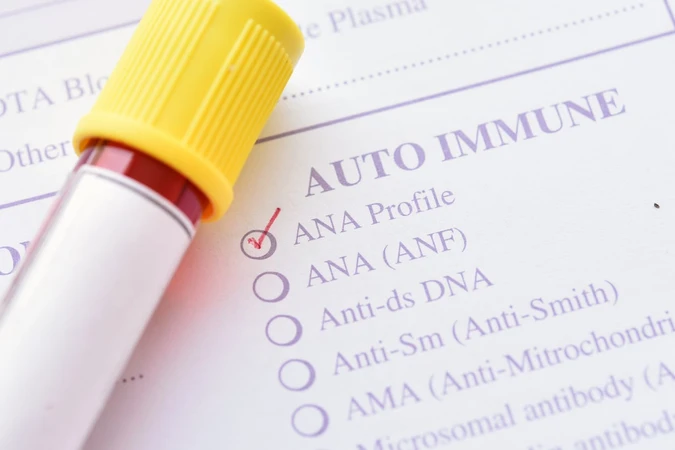 Autoimun (Autoimmune)