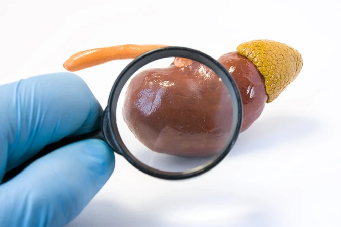 Sindrom Nefrotik (Nephrotic Syndrome)