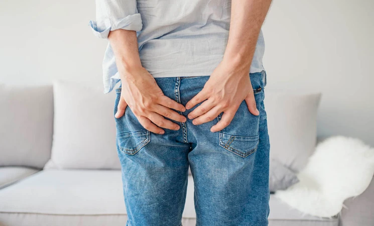 Pilonidal Cyst (Kista Pilonidal)