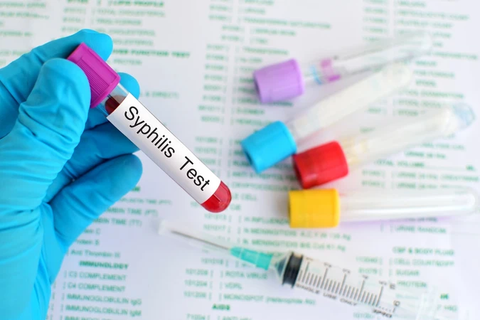 Sifilis (Syphilis)