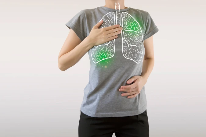 Pneumonia Aspirasi (Aspiration Pneumonia)