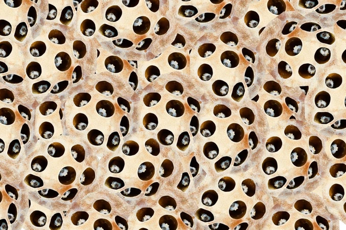 Trypophobia