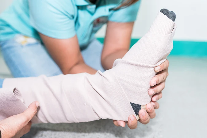 Lisfranc Fracture (Fraktur Lisfranc)