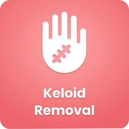 Keloid Removal
