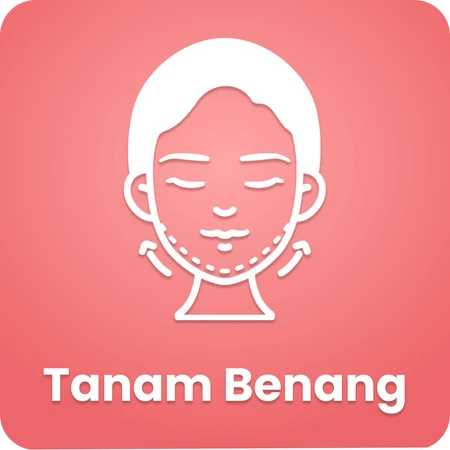 Tanam Benang