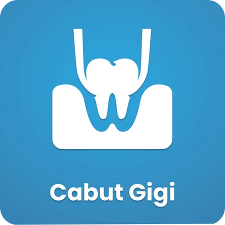 Cabut Gigi