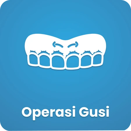 Operasi Gusi