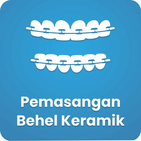 Pemasangan Behel Keramik
