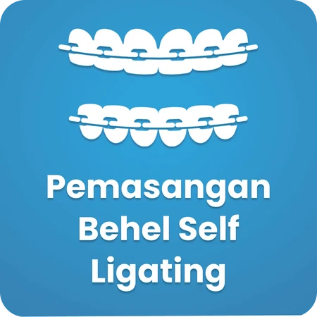Pemasangan Behel Self Ligating