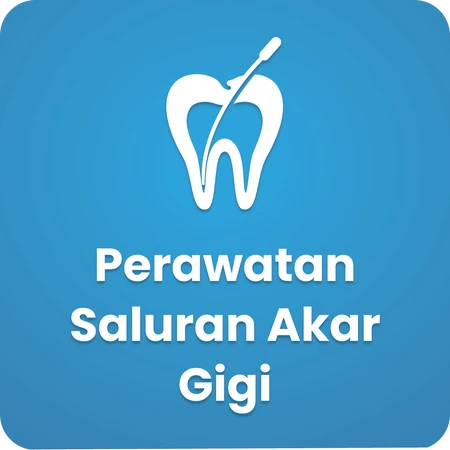 Perawatan Saluran Akar Gigi
