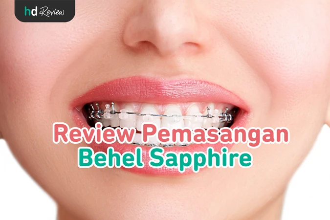 Pemasangan Behel Sapphire reviews