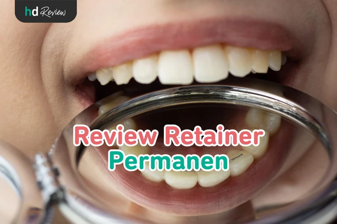 Retainer Permanen reviews