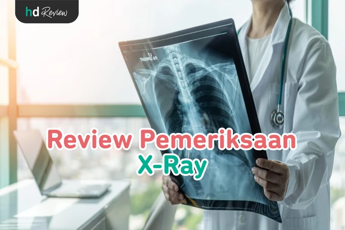 X-Ray reviews