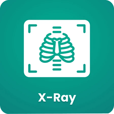 X-Ray