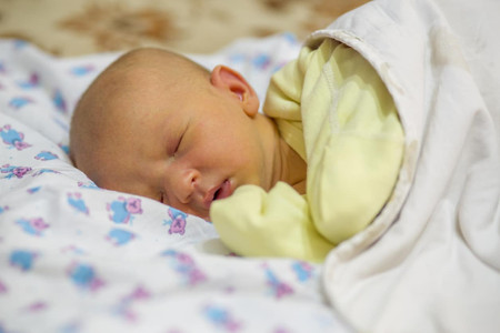 Cermati Penyakit Kuning Pada Bayi, Normal atau Bahaya?