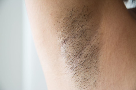 Shaving Arms: Pros & Cons, Side Effects, and How to Do It Properly