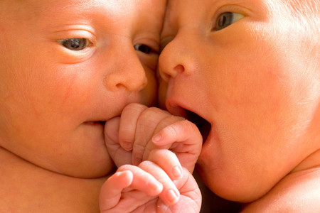 8 Jenis Bayi Kembar Siam