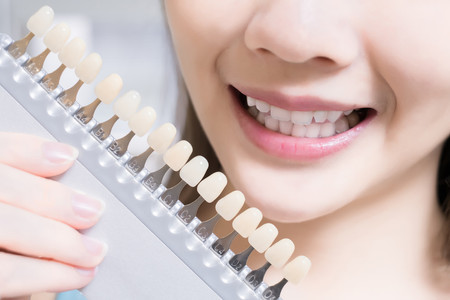 3 Metode Sederhana untuk Memutihkan Gigi Dengan Cepat