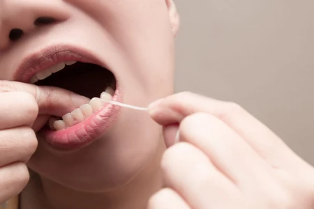 Pentingnya Flossing Gigi