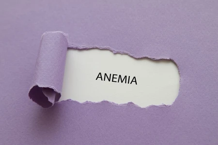 Anemia Sembuh Tanpa Kambuh dengan Obat Ini