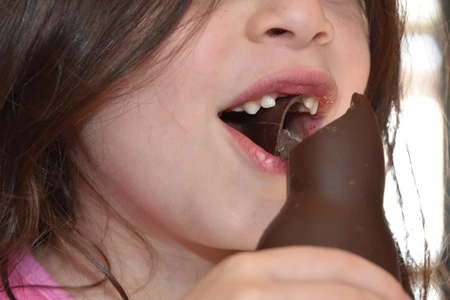 18 Penyebab Gigi Keropos dan Solusi Menghindarinya