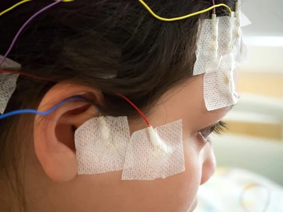 Epilepsi Pada Anak Sebabkan Kejang Tanpa Sadar