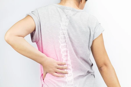 Tips Cegah Risiko Osteoporosis Sejak Dini