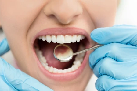 3 Teknologi Terbaru untuk Perawatan Gigi dan Mulut