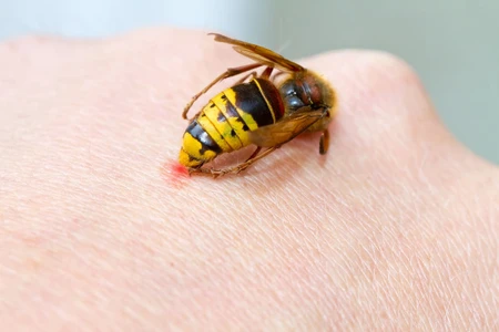 Sengatan Lebah Pada Anak: Penyebab, Gejala, dan Obat