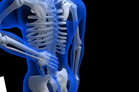 Cara Mengetahui Apakah Tulang Anda Kuat Atau Tidak 