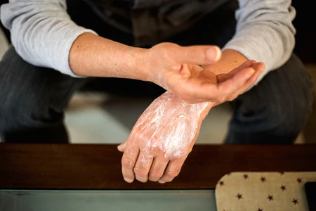 Memahami Caladine Lotion dan Cara Memilih Obat Topikal yang Tepat