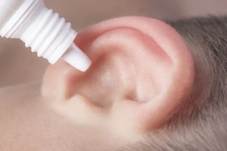 Jangan Abaikan Otomikosis, si Infeksi Jamur pada Telinga