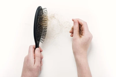 Cara Mengatasi Rambut Rontok Secara Medis