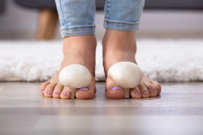 Krim dan Tablet, Obat Jamur Kulit Ampuh Ini Bisa Ditemukan di Apotek