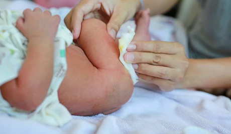 Bayi Susah Bab? Berikut Tips Melancarkan Bab Bayi